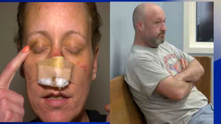 Attempted murder charge filed against nose biting suspect in Horry County (Image 1)_53003