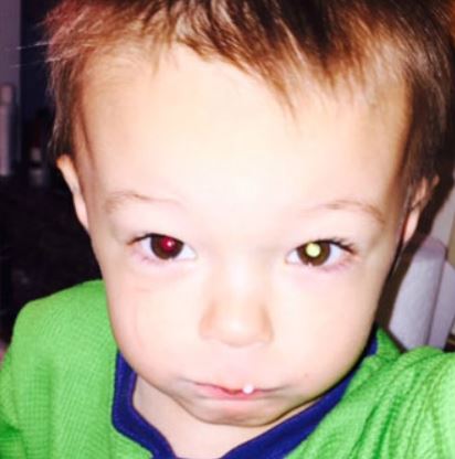 Life-saving photo_ Mom discovers 2-year-old son's eye cancer after taking picture (Image 1)_58212