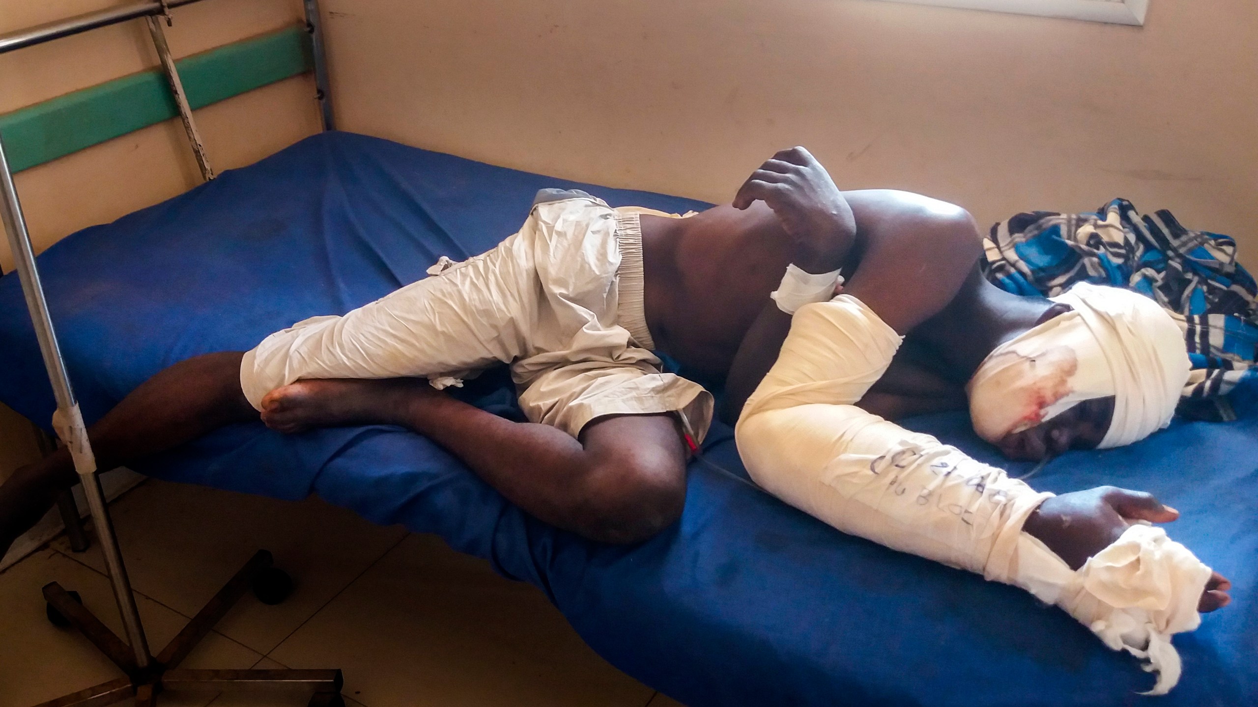 FILE - Saga Saganla, 30, from Diawely, lies on his bed at Somine Dolo hospital in Mopti, Mali, Friday June 24, 2022. Saganla survived an attack by nearly 100 jihadis on motorbikes. Top human rights groups have released new reports in which they documented cases of “war crimes” against civilians in the violent conflict in Africa’s Sahel region where rebels are increasingly fighting in communities under siege. The reports focusing on Burkina Faso and Mali were separately released this week by the Human Rights Watch and Amnesty International. (AP Photo/ Hamidou Saye, File)